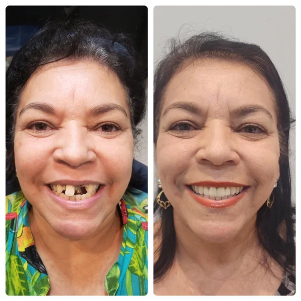 Dona Neide, paciente da Clínica Benvenutti