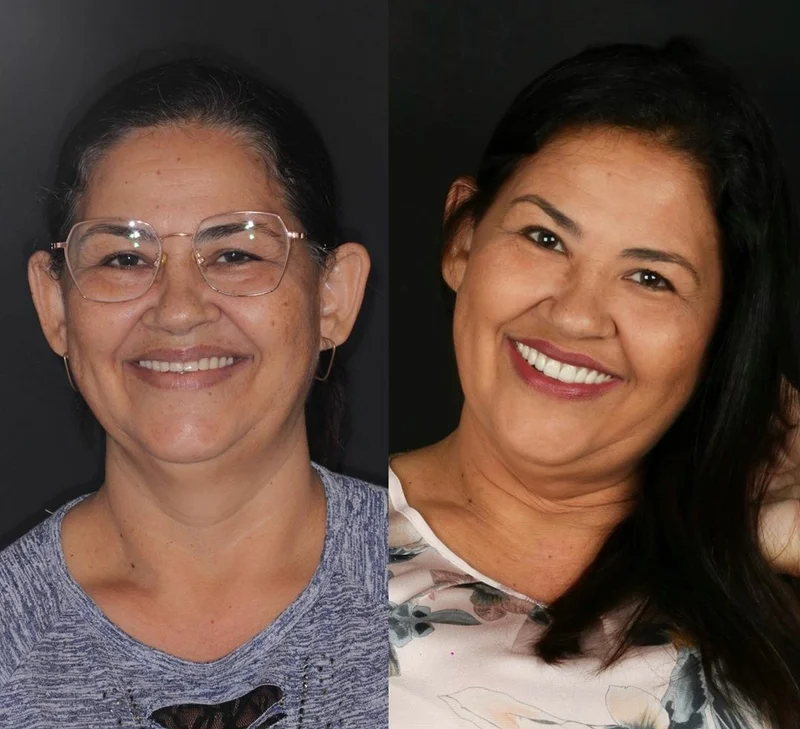 Paciente sorrindo após tratamento na Clínica Benvenutti